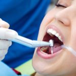 Check out some tips to choose the ideal dentist near you at Kolkata