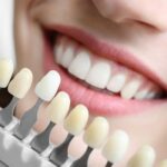 Everything About Cosmetic Dentistry You Must Know