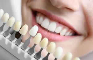 Everything About Cosmetic Dentistry You Must Know