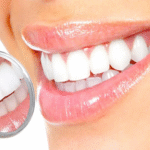 Dental Crowns Newport Beach: When Is a Crown the Best Solution for a Damaged Tooth?
